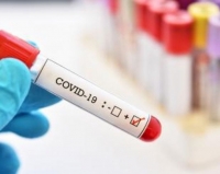 COVID-19 с нов рекорд днес  