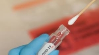 Без лимити за направления за PCR изследвания 