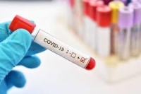 Проф. Витанов: Над 2000 случая на COVID-19 на ден застрашава системата 