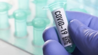  Футболист на ЦСКА е с положителна проба за COVID-19