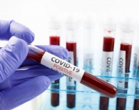 603 нови случая на COVID-19, 32 в Бургас 